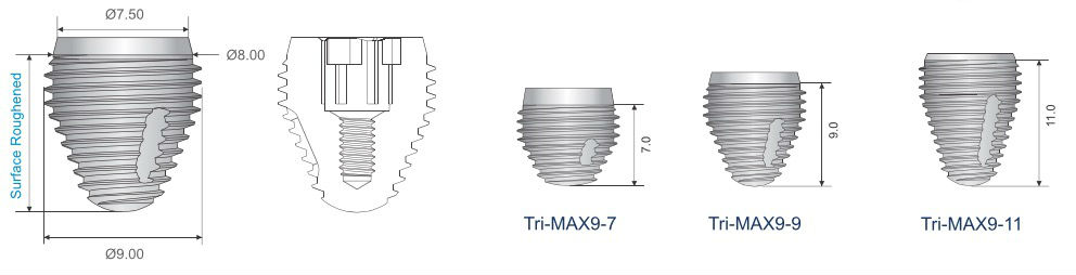 Southern Implants