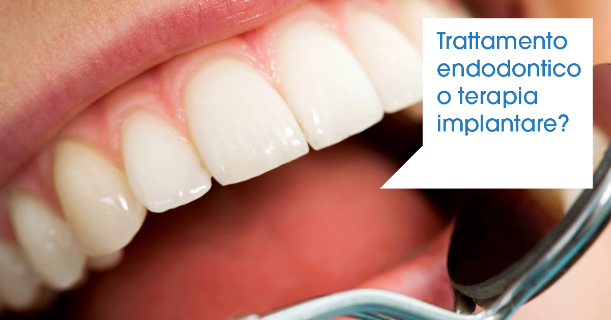 Trattamento endodontico o terapia implantare - Faggian Clinic